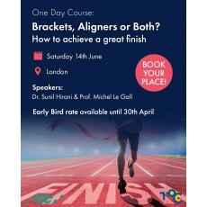 Brackets, Aligners or Both? How to achieve a great finish