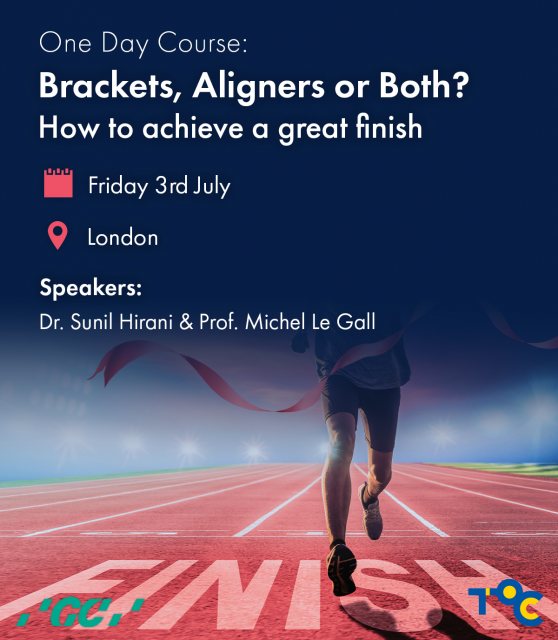 Brackets, Aligners or Both? How to achieve a great finish